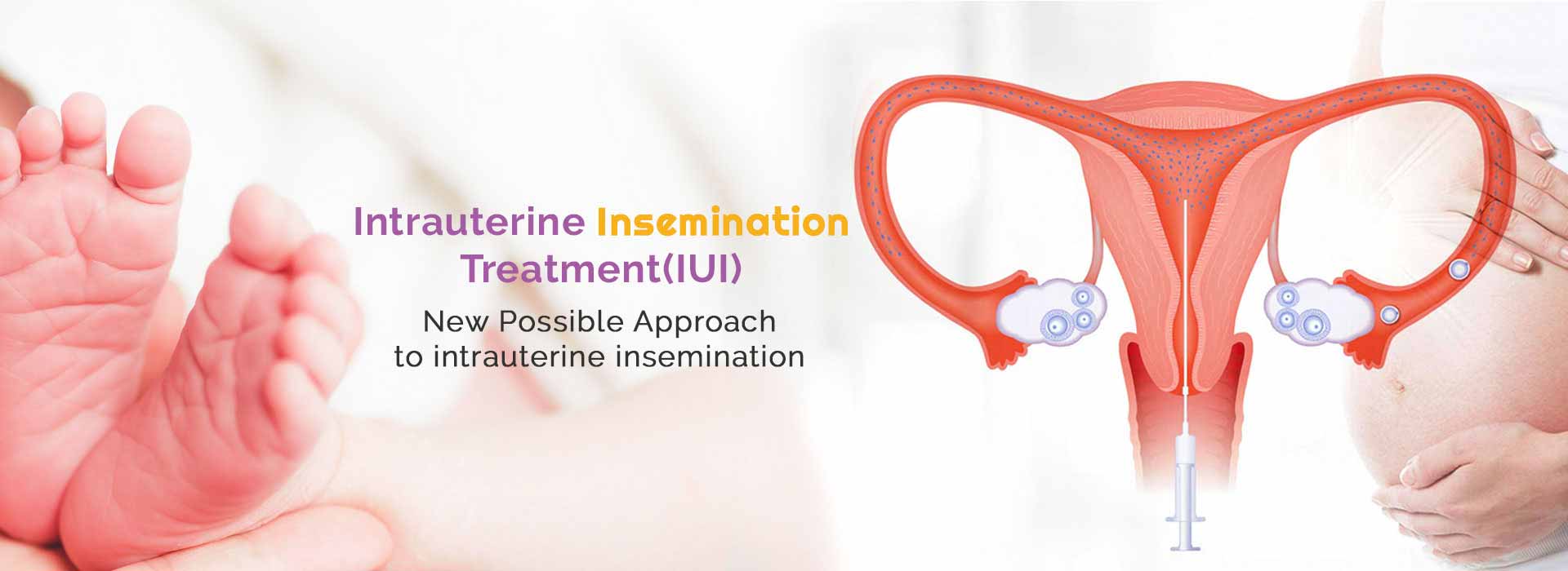 Intrauterine Insemination in Lodi Colony