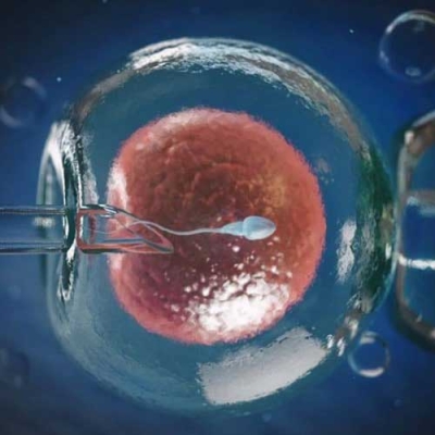 Intracytoplasmic Sperm Injection (ICSI) in Pamposh Enclave
