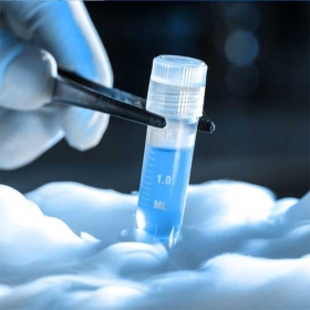 Sperm Freezing in Raja Garden